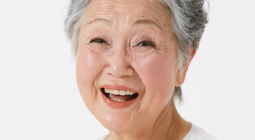 Facelift Before and After 55-Year Old