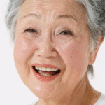 Facelift Before and After 55-Year Old